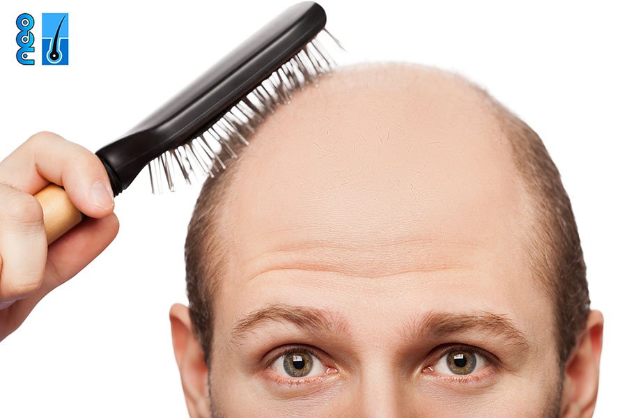 which-vitamin-deficiencies-cause-hair-loss-neo