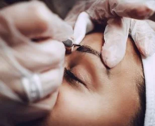 eyebrow transplantation - Neohair