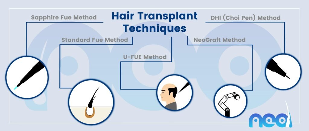 Hair Replacement Turkey Hair Transplant Techniques