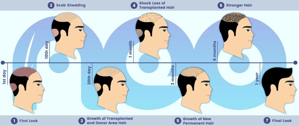 neo-image-healing-process-01-min-1024x434.jpg